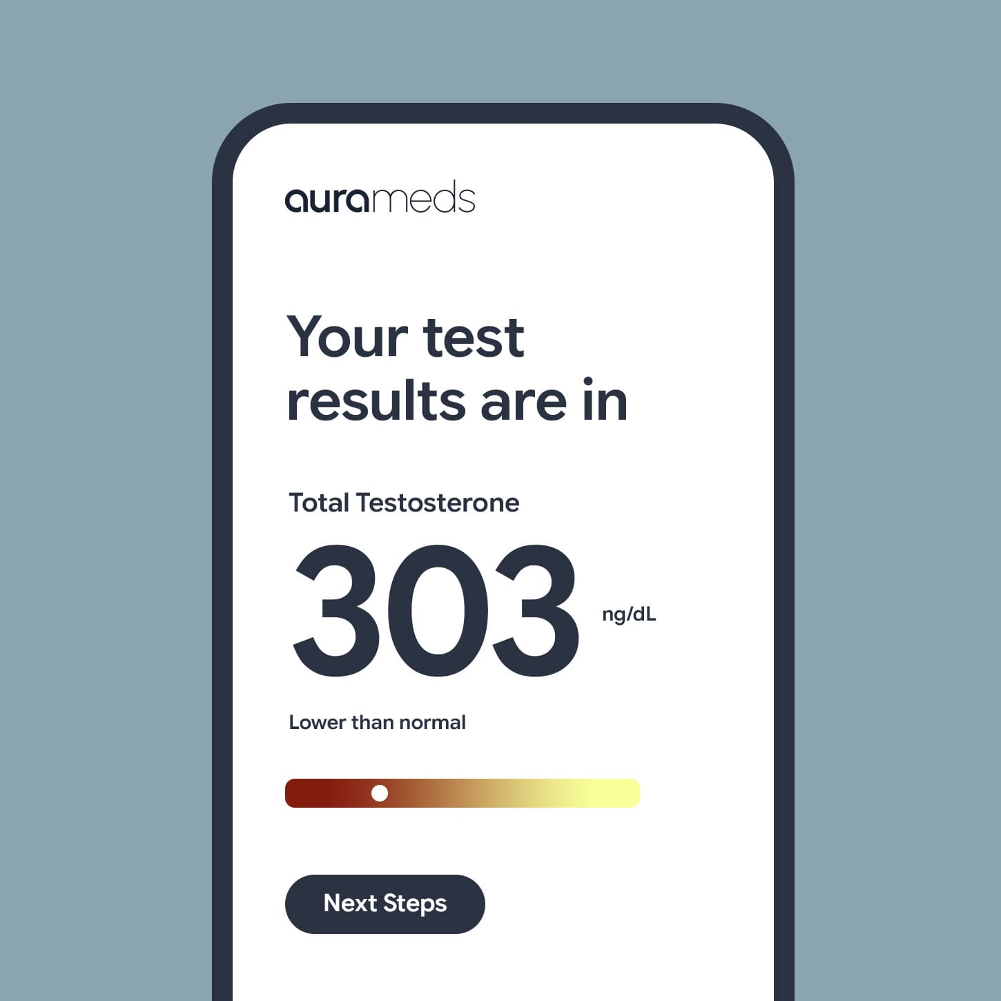 Phone showing a total testosterone result of 303 ng/dL